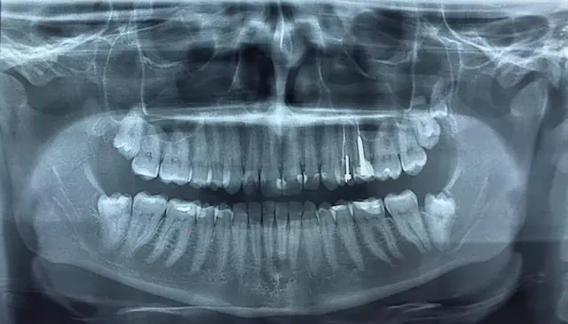 Odontólogo 3 Médico Venezuela Panorámica Dental